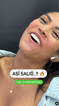 Video dinámico dental